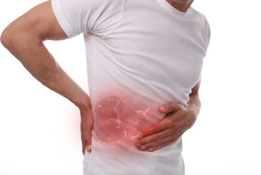 पीठ या पेट में दर्द हो तो न करें नजरंदाज? हो सकता है किडनी स्टोन का संकेत